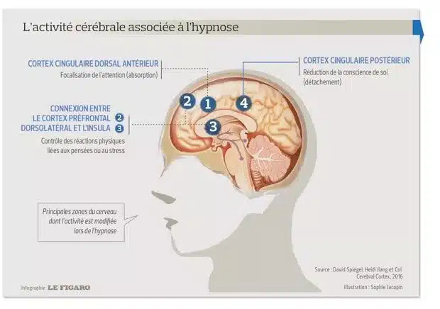 cerveau et hypnose pour la gestion du stress